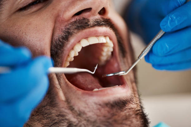 Laser Dentistry in Rogersville, MO